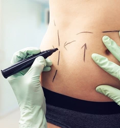 body contouring la jolla