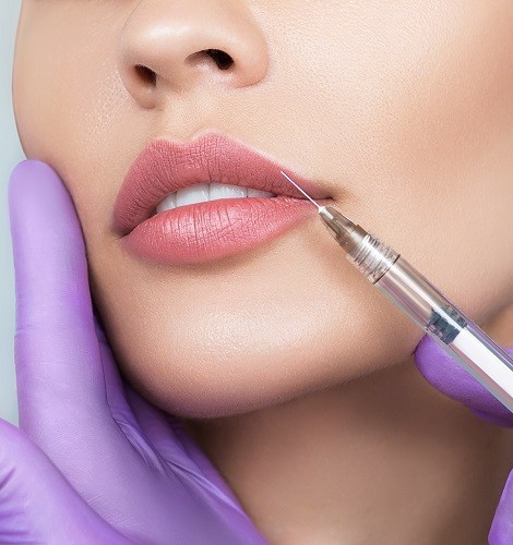 collagen injections la jolla