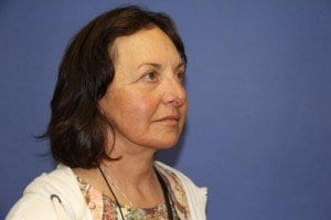 After Image: Facelift Surgery - right-front-oblique