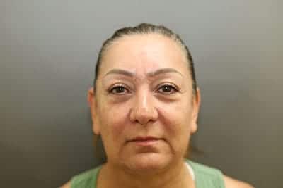 Before Image: Neck Lift - front