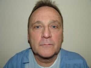 Before Image: Neck Lift - front