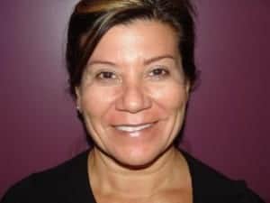 Before Image: Neck Lift - front