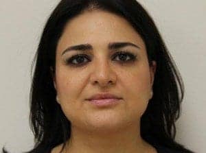 After Image: Neck Liposuction - front