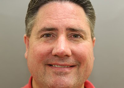 After Image: Rhinoplasty For Men - front