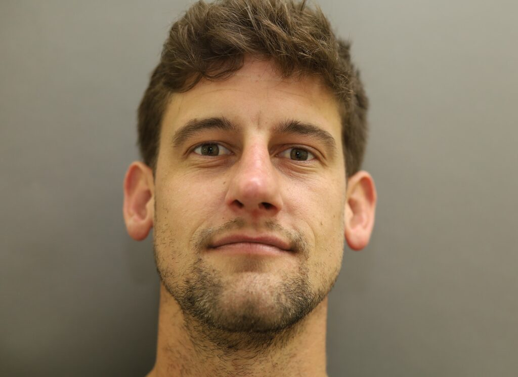 After Image: Rhinoplasty For Men - front