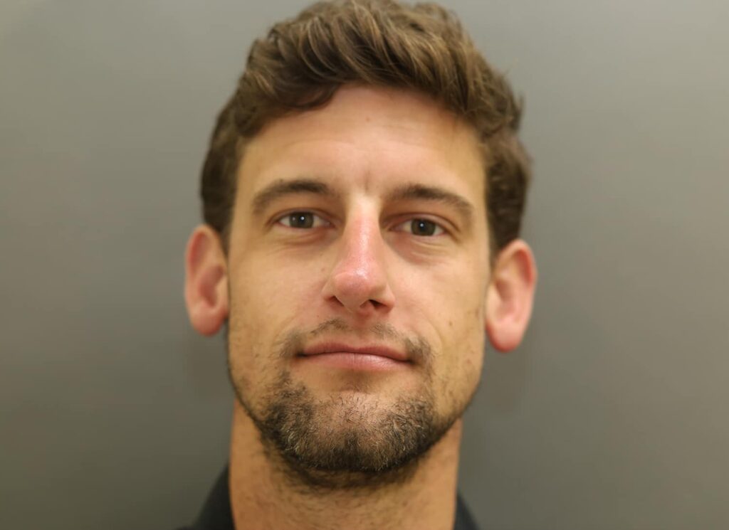 Before Image: Rhinoplasty For Men - front