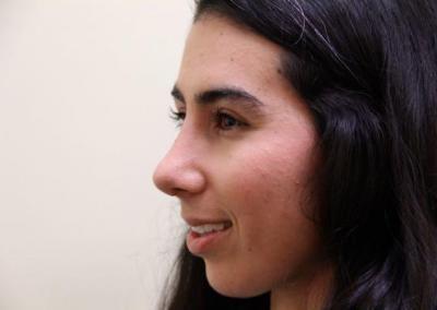 After Image: Rhinoplasty For Men - left-side
