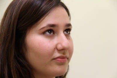 After Image: Rhinoplasty For Men - right-front-oblique