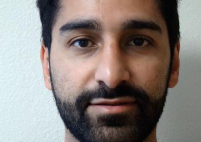 After Image: Rhinoplasty - front