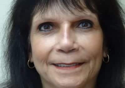 After Image: Rhinoplasty - front