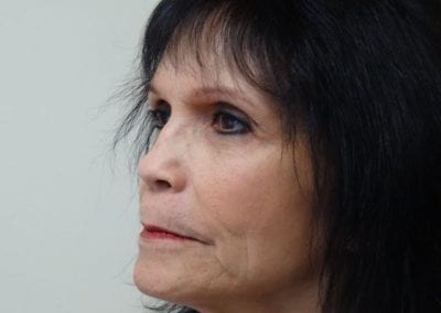 Before Image: Rhinoplasty - left-front-oblique
