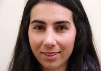After Image: Rhinoplasty - front