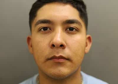 Before Image: Rhinoplasty - front