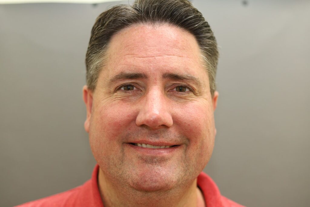 After Image: Rhinoplasty - front