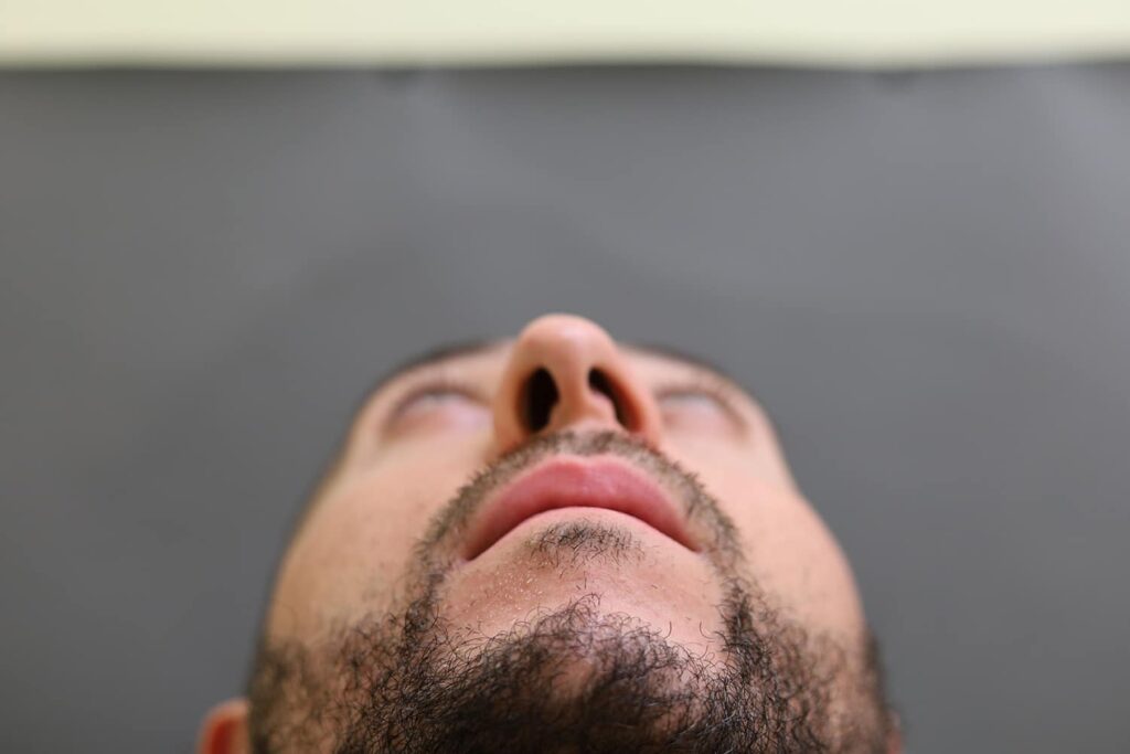 Before Image: Rhinoplasty - front