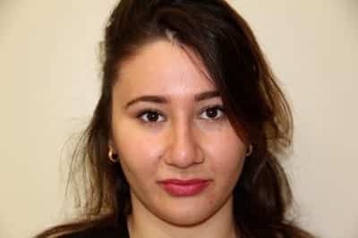 After Image: Rhinoplasty - front