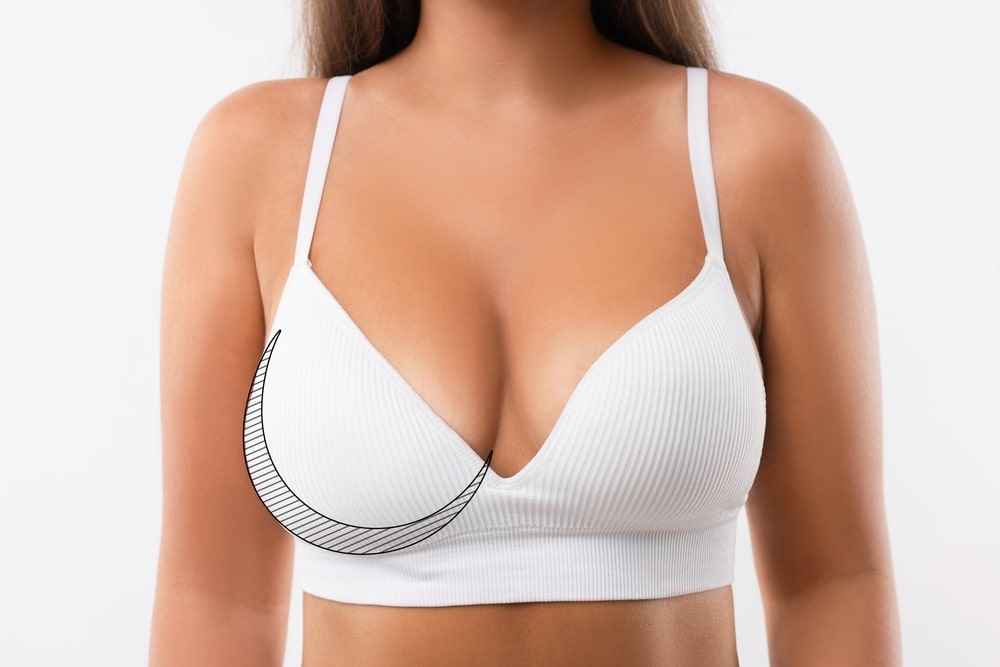 Breast Asymmetry Surgery in San Diego & Coronado, CA 5 1774481920 317954fe50f1401390973c3295eb447b 1 updated